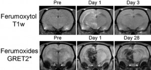 Figure 2. Transvascular delivery. Signal intensity was evaluated over time, before and after transvascular delivery of iron oxide nanoparticles in rat brain. Top: T1-weighted MRI of ferumoxytol (pre, 1 day, 3 day). Bottom: GRET2* MRI of Feridex (pre, 1 day, 28 day).Reprinted with permission from Muldoon et al, Neurosurgery 2005.