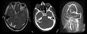 Figure 4 from Maralani